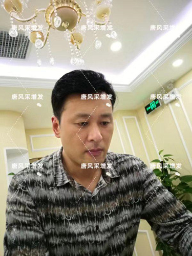 嘉興假發(fā)片定制哪家好？唐風采增發(fā)成了首選！