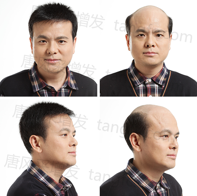常剃光頭后，頭發(fā)變好了？這是視覺效果！