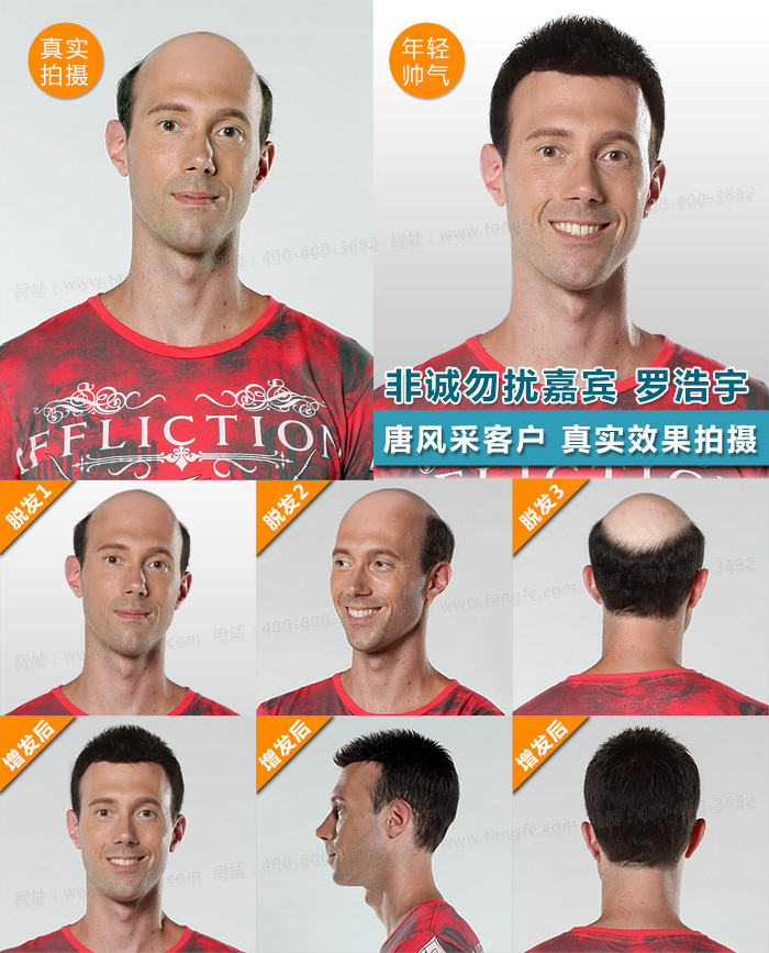 西寧假發(fā)片定制哪家好？ 為什么現(xiàn)在都不買成品假發(fā)了？