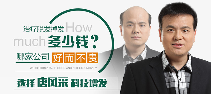 西寧買隱形假發(fā)哪家好？多少錢才能買到？