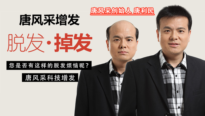 臺(tái)州買假發(fā)哪家好？如何挑選適合的假發(fā)？