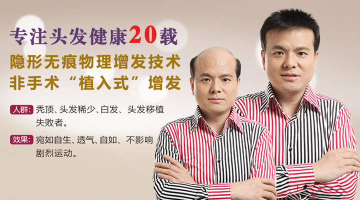西寧織發(fā)補發(fā)機構(gòu)哪家好？肯定唐風(fēng)采增發(fā)