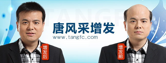 西寧哪里有假發(fā)專賣店 唐風(fēng)采增發(fā)