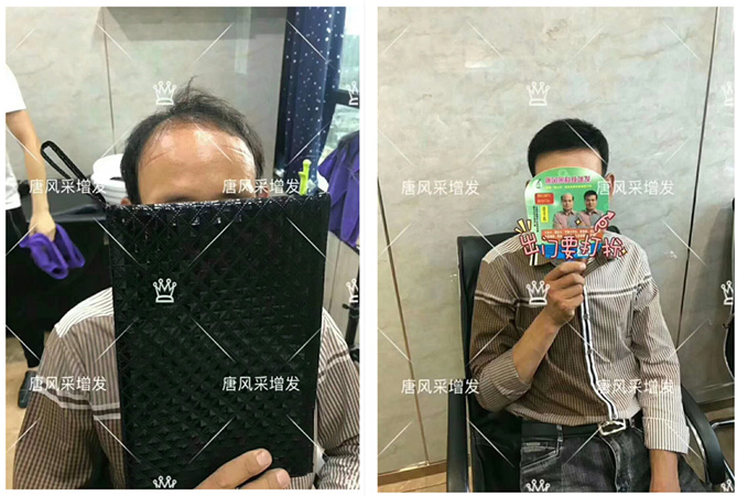 成都逼真的假發(fā)哪里有賣？
