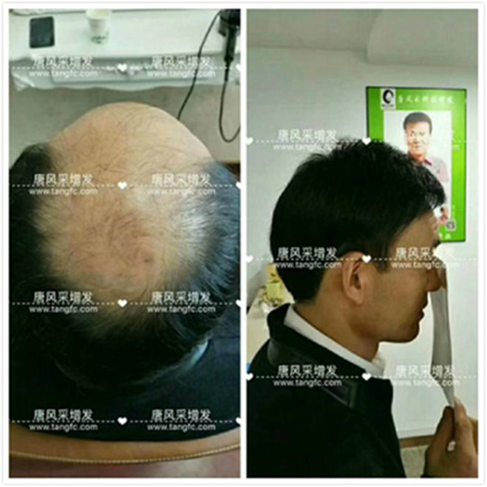 天津補發(fā) 客戶案例