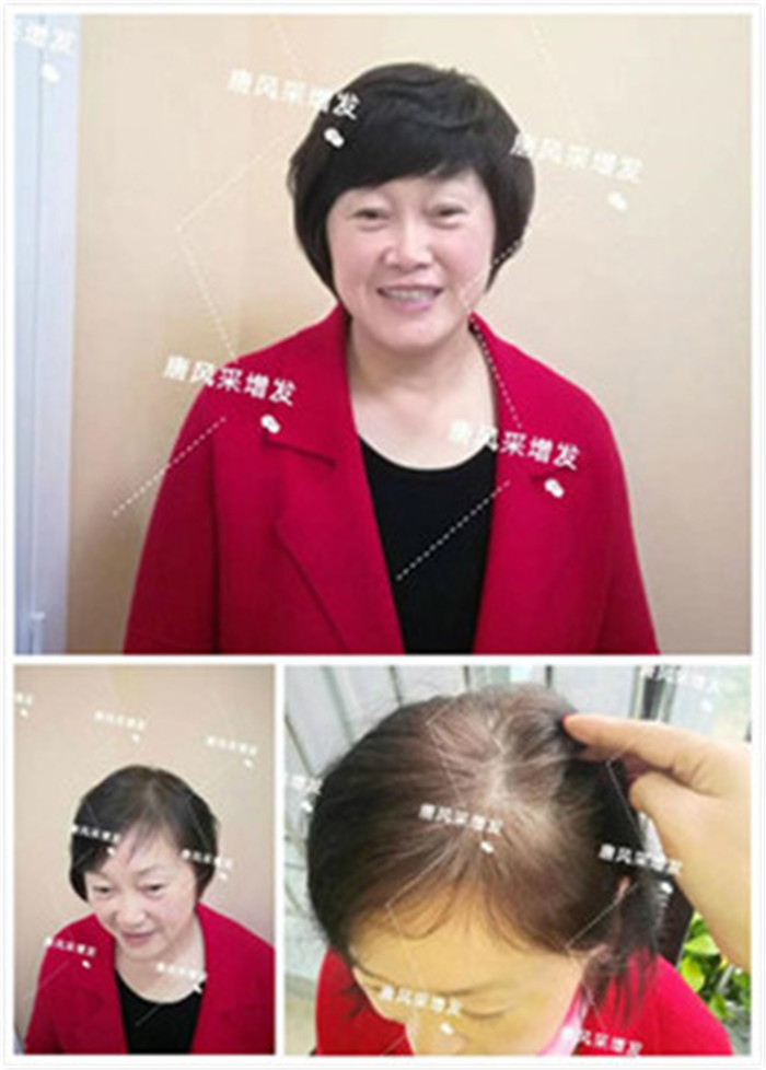 包頭假發(fā)什么牌子好？一定要選準(zhǔn)品牌精品