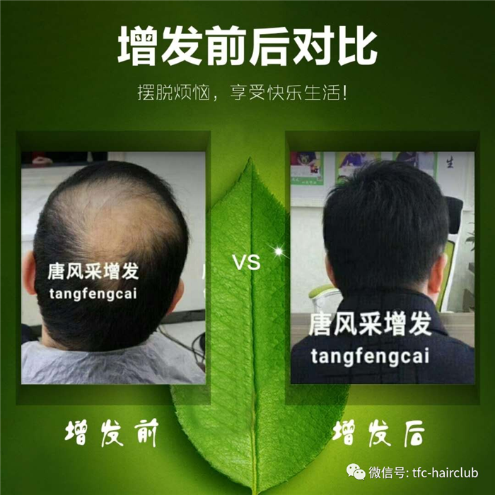 包頭哪里有真發(fā)假發(fā)套的專賣店？