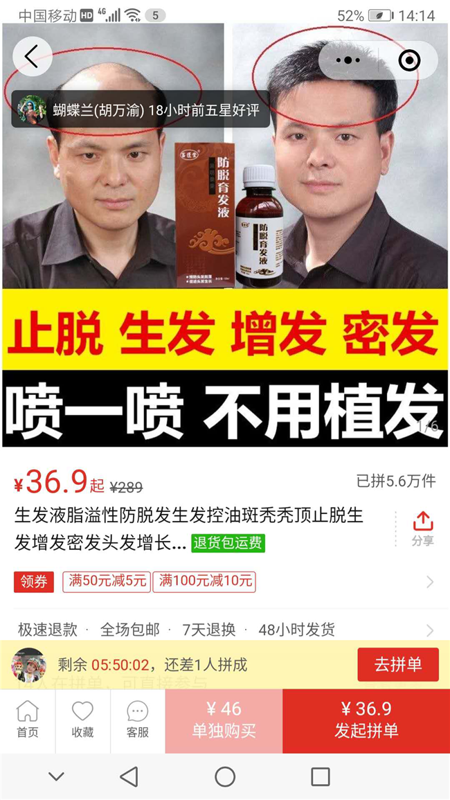 某品牌生發(fā)液。