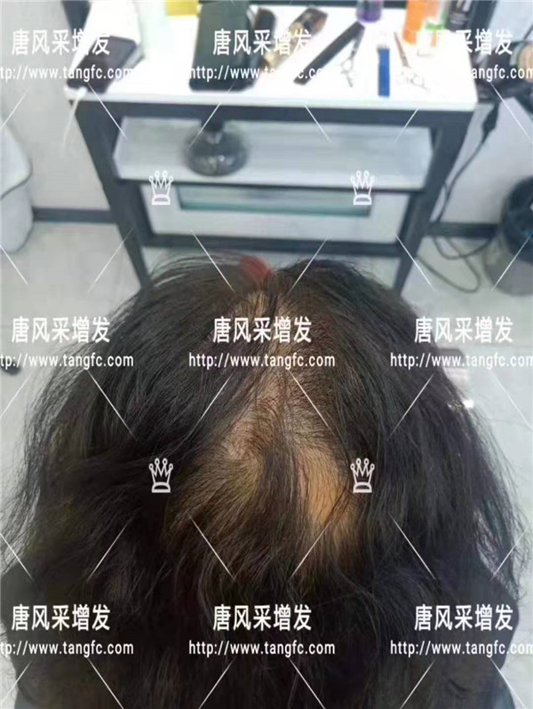 時(shí)尚假發(fā) 官方二維碼 唐風(fēng)采無(wú)痕假發(fā)