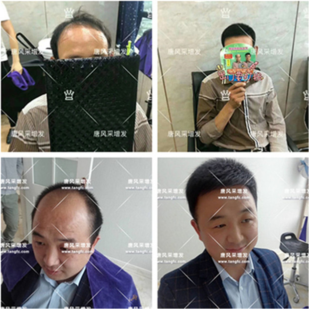 真人頭發(fā)假發(fā)套 唐風采客戶案例