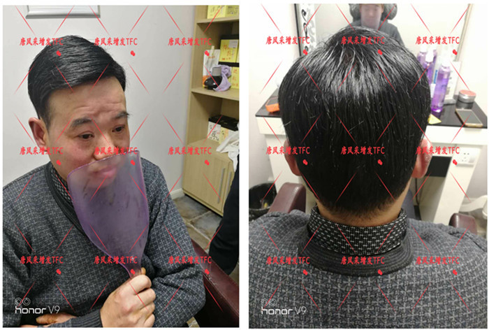 真人頭發(fā)假發(fā)套 唐風采隱形增發(fā)客戶案例