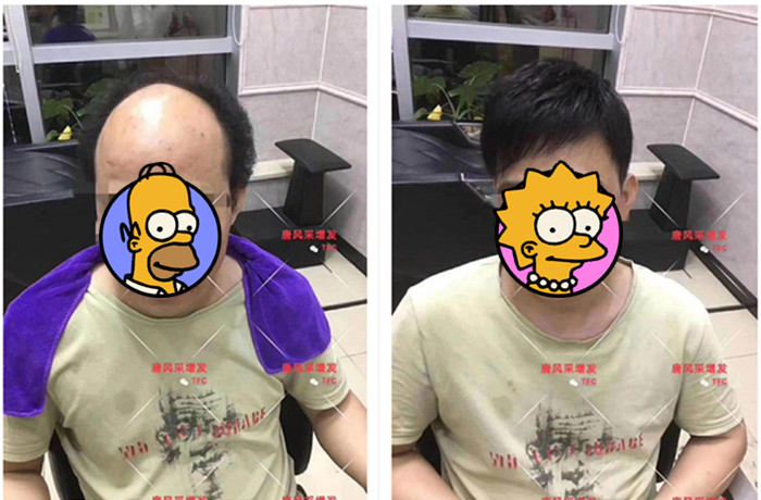 隱形增發(fā) 唐風(fēng)采真實(shí)案例