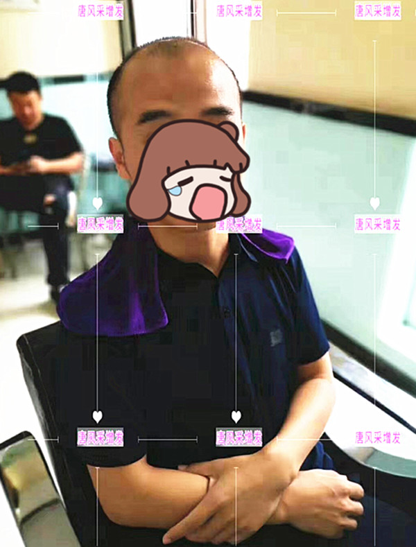 隱形增發(fā) 唐風(fēng)采真實(shí)案例