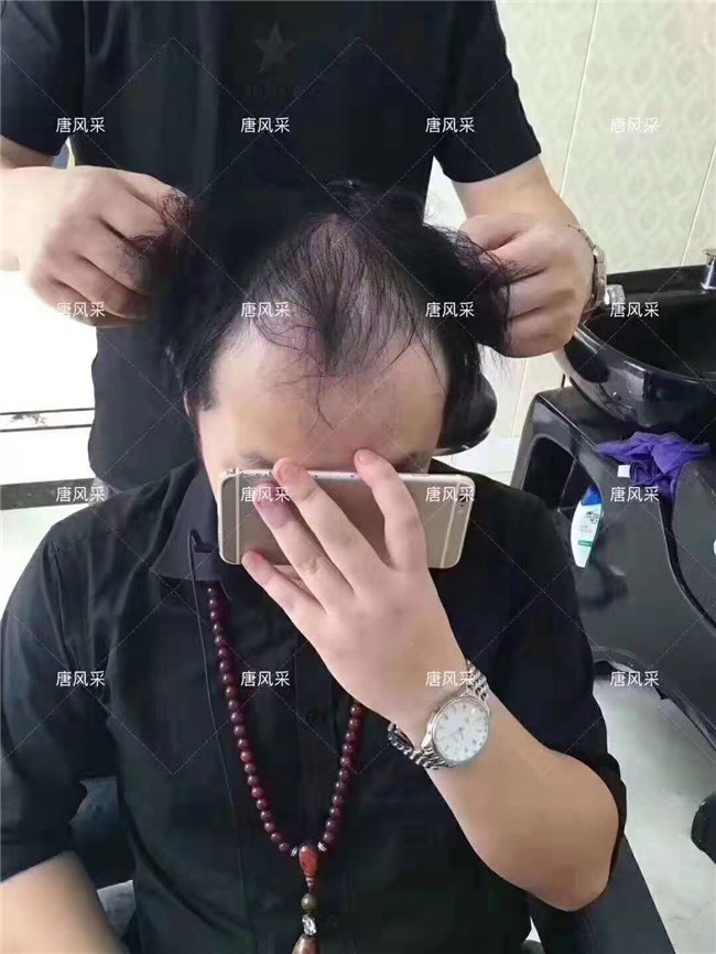 無(wú)痕真發(fā)發(fā)套 唐風(fēng)采客戶(hù)案例
