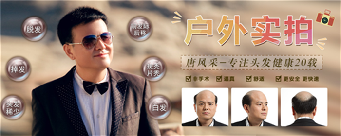 真發(fā)假發(fā)專賣店 唐風采高檔假發(fā)售后服務