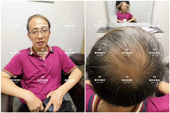 真發(fā)頭套專賣店 唐風采客戶增發(fā)前