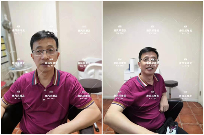 真發(fā)頭套專賣店 唐風采客戶增發(fā)后