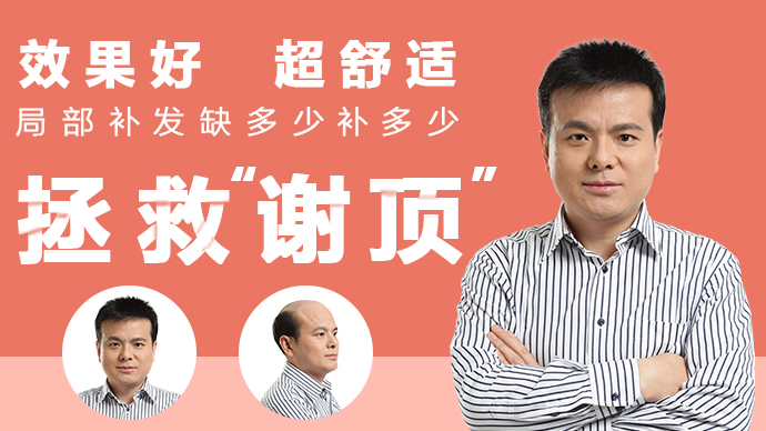 補(bǔ)發(fā)多少錢 根據(jù)做的面積大小收費