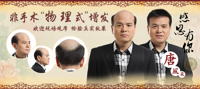 隱形補(bǔ)發(fā)多少錢 想體驗補(bǔ)發(fā)可以到唐風(fēng)采試試