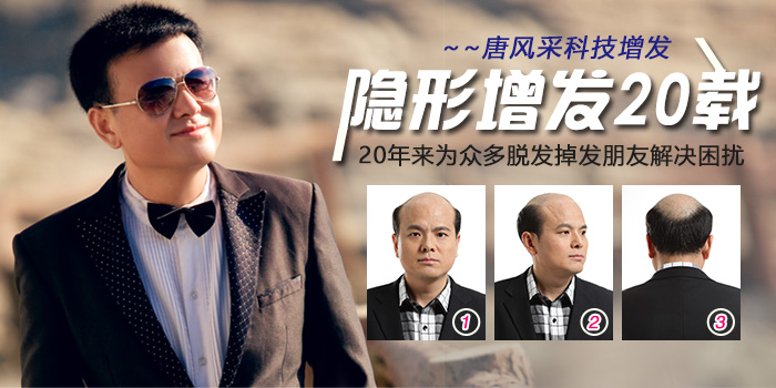 頭頂粘貼假發(fā)片 唐風采黏貼式假發(fā)片深受發(fā)友喜愛
