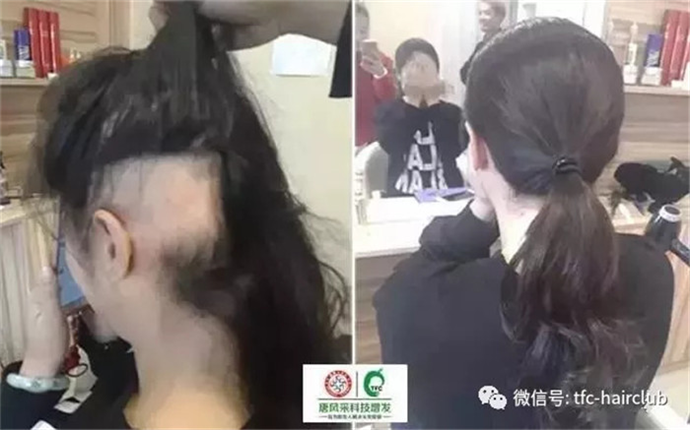 假發(fā)鬢角處怎么看著自然一點(diǎn) 量身定制假發(fā)的真實(shí)感
