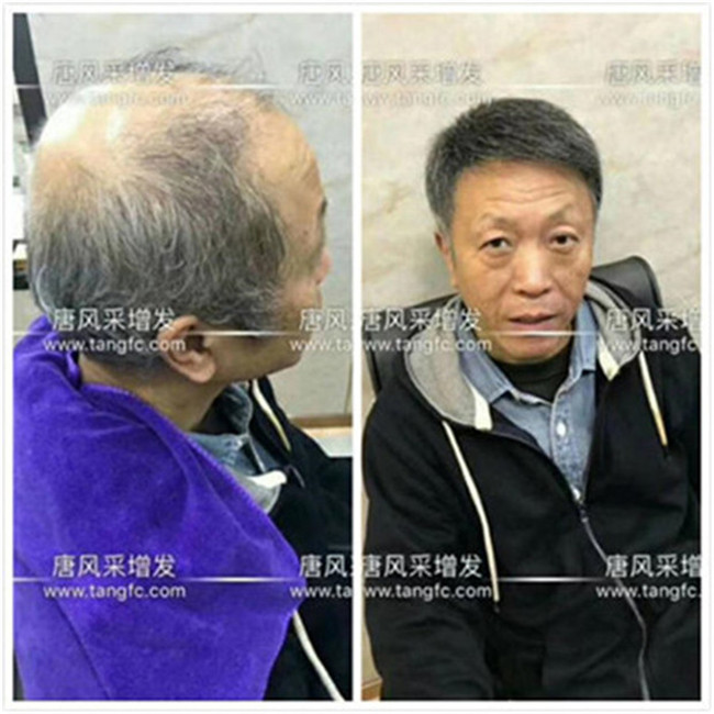中老年男士真發(fā)假發(fā) 唐風(fēng)采客戶自然真實的佩戴效果