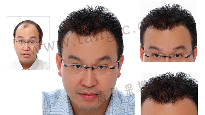 如果你hold不住謝頂，可以來試試真人頭發(fā)的假發(fā)