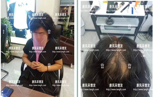 女生戴膠沾假發(fā) 唐風(fēng)采客戶案例