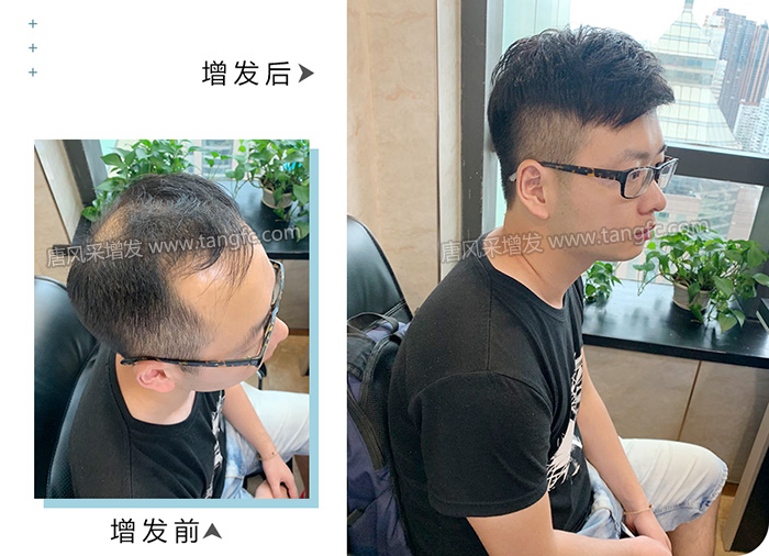 一次自然補發(fā)能用多久 \