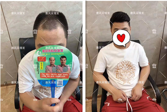 買(mǎi)男士假發(fā) \