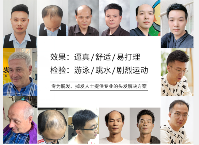 假發(fā)片頭頂補(bǔ)發(fā)片 \