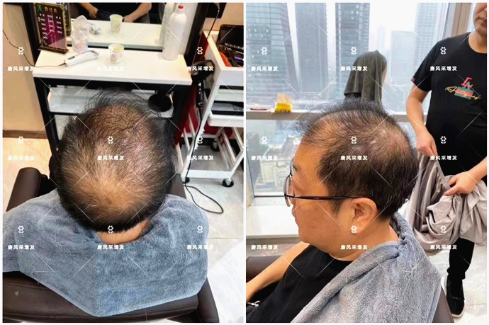 假發(fā)片頭頂補(bǔ)發(fā)片 \