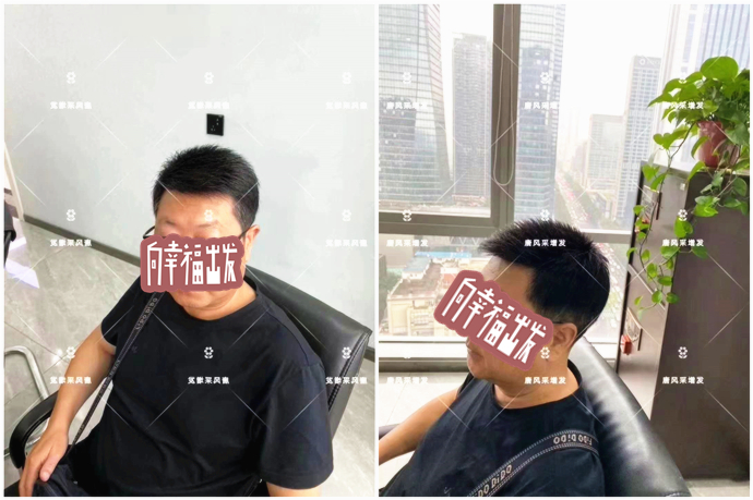 頭頂補(bǔ)發(fā)片 \