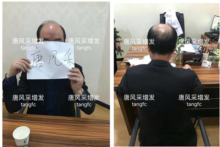 假發(fā)套一般價(jià)格多少錢 \