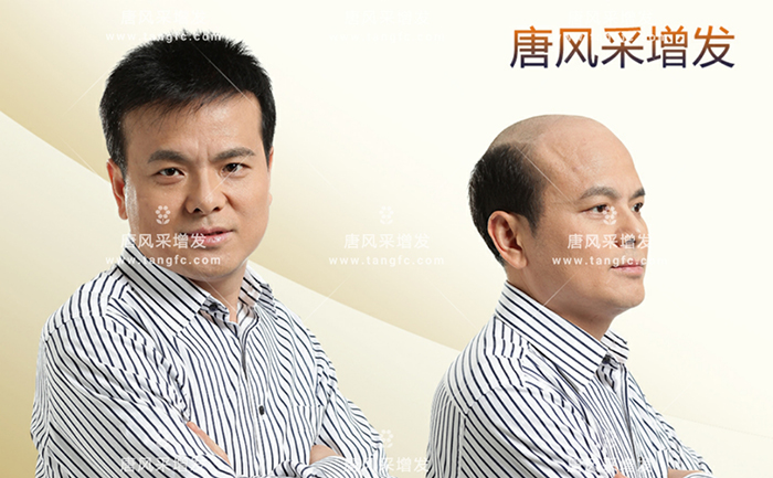 隱形補發(fā) \