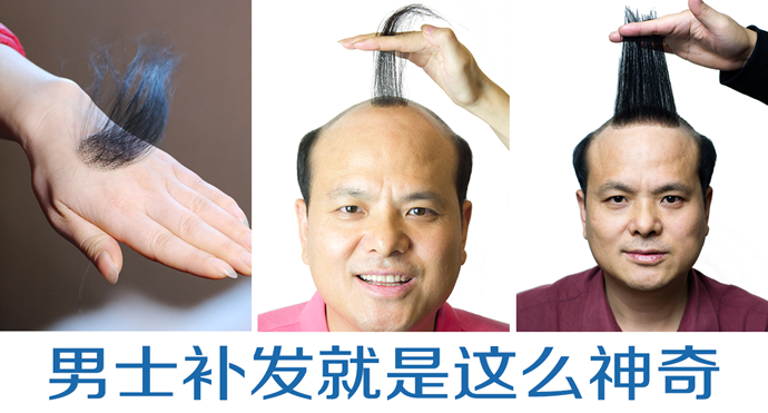 以發(fā)補(bǔ)發(fā) \