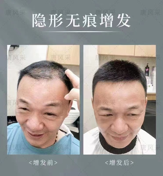 假發(fā)私人定制實體店 \