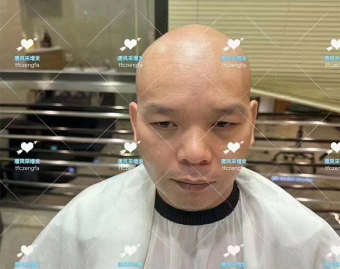 織發(fā)補(bǔ)發(fā) \