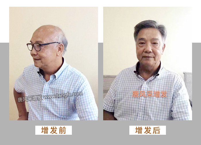 假發(fā)要多少錢(qián) \