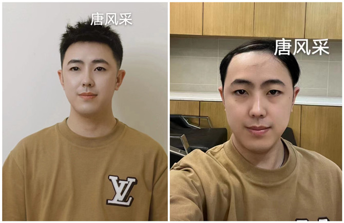 隱形補(bǔ)發(fā)塊 官方二維碼 \