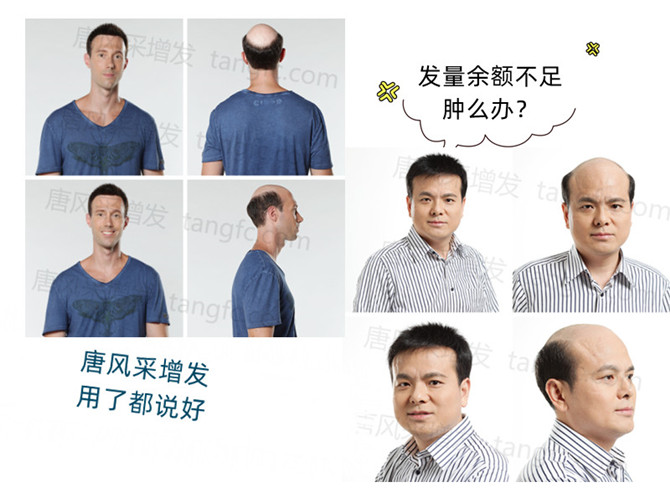 蘇州男士假發(fā)銷(xiāo)售量 \