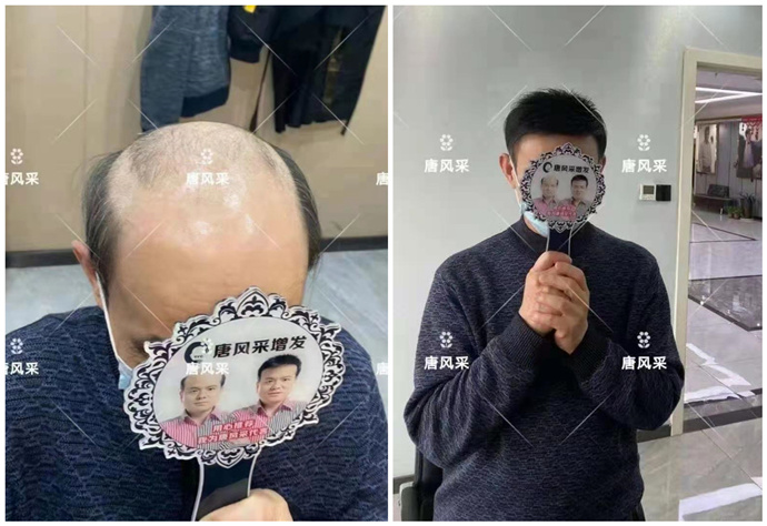 蘇州男士假發(fā)銷(xiāo)售量 \