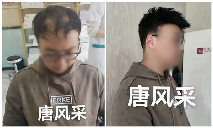 蘇州男士假發(fā)銷(xiāo)售量 \