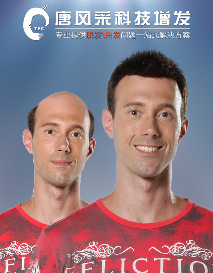 蘇州男士假發(fā)銷(xiāo)售量 \