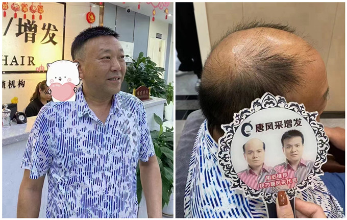 長沙假發(fā)實(shí)體店 \