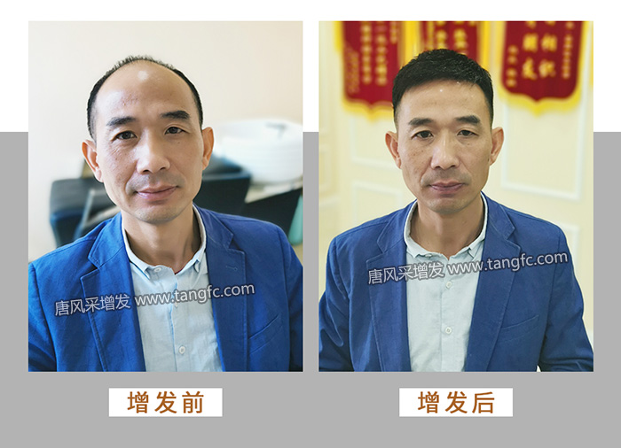 長(zhǎng)沙岳麓區(qū)假發(fā)專(zhuān)賣(mài)店 \