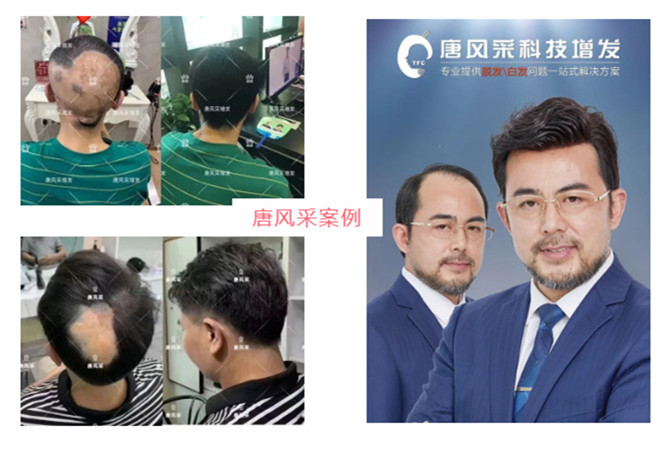 朝陽(yáng)男士假發(fā)店 \