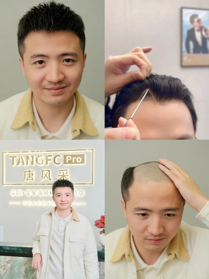 朝陽(yáng)男士假發(fā)店 \