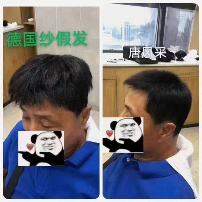 男補(bǔ)發(fā)假發(fā) \