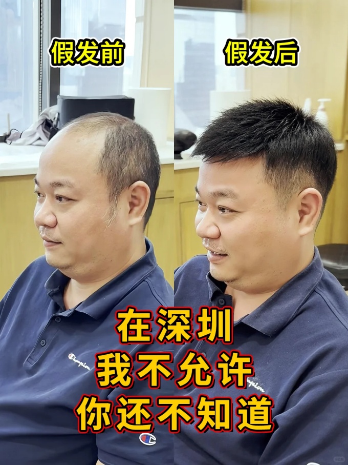 深圳假發(fā) \